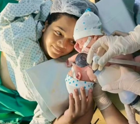 Morre o segundo gêmeo siamês de Canarana (MT) que nasceu em Goiânia